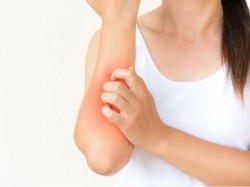 Kulit Bisa Merah dan Kusam Akibat Polusi, Apa yang Harus Dilakukan?