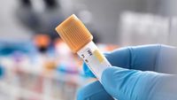 Hari AIDS Sedunia, Catat 5 Fakta Virus HIV yang Mematikan