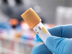 Angka Penularan HIV di Australia Terendah dalam 18 Tahun