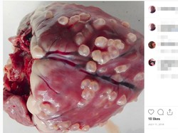 Viral Foto Jantung Penuh Cacing Akibat Makan Daging Babi Belum Matang