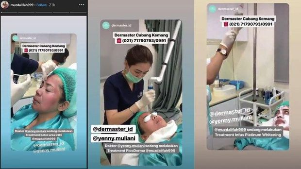 Syarat dan Prosedur Suntik Botox seperti Dilakukan Muzdalifah