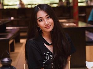 10 Tahun Pakai Lensa Kontak, Kelopak Mata Selebgram Ini Jadi Beda Sebelah