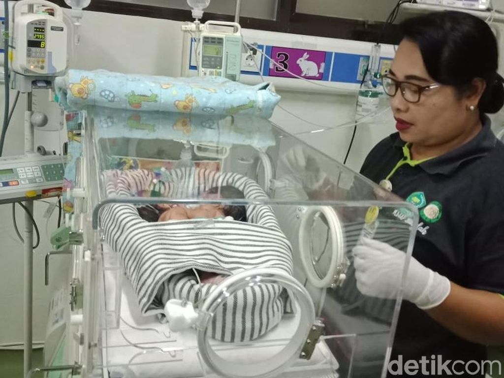 RSUP Sanglah Optimistis Bayi Kembar Siam di Bali Bisa Dipisahkan RSUP Sanglah Optimistis Bayi Kembar Siam di Bali Bisa Dipisahkan