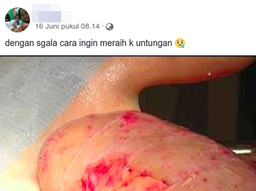 Viral Geng Pencuri Ginjal, Ini Faktanya Viral Geng Pencuri Ginjal, Ini Faktanya