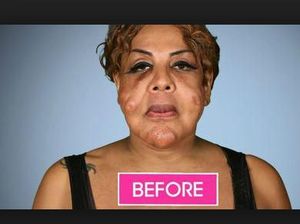 Transgender Berwajah Rusak Dulu Viral, Begini Penampilannya 14 Tahun Kemudian