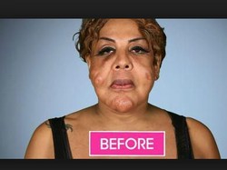 Transgender Berwajah Rusak Dulu Viral, Begini Penampilannya 14 Tahun Kemudian