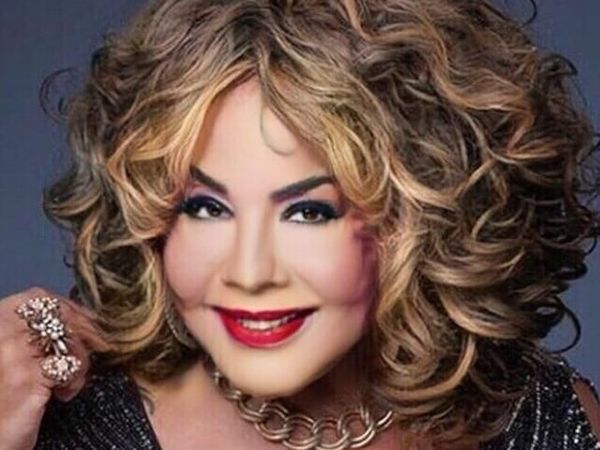 Foto Before - After Transgender Berwajah Rusak yang Kini Telah Divermak