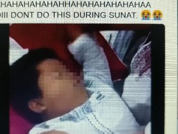 Ngakak! Begini Strategi Bocah yang Takut Sunat