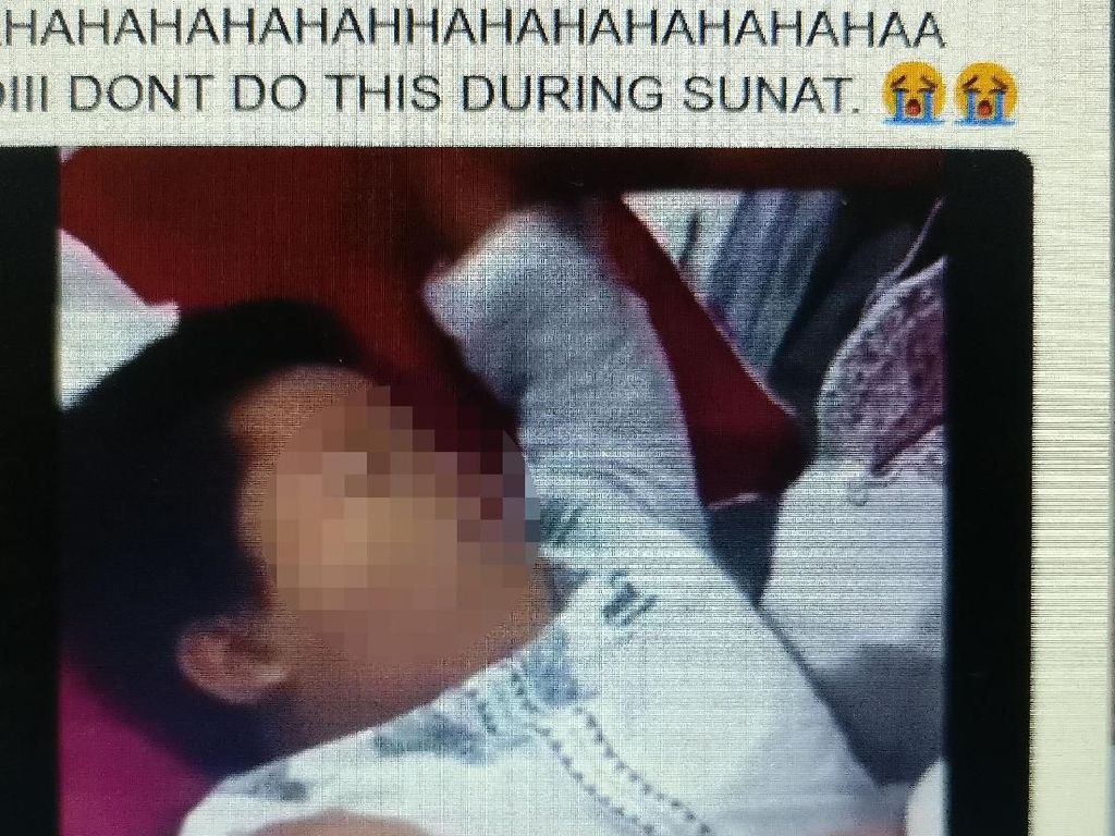 Viral Ekspresi Kocak Anak Pura-pura Pingsan Waktu Disunat Viral Ekspresi Kocak Anak Pura-pura Pingsan Waktu Disunat