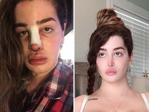 Penampilan Wanita Pemuja Oplas, Implan Payudara Sampai Lepas Tulang Rusuk