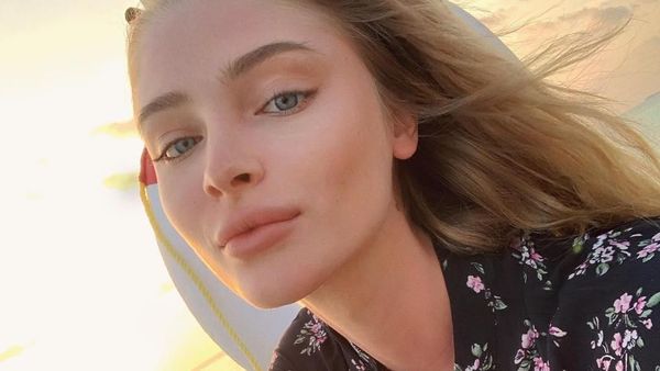 Potret Model yang Dihujat karena Pamer Senyum Baru Habis Operasi Gigi