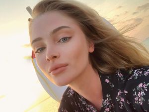 Potret Model yang Dihujat karena Pamer Senyum Baru Habis Operasi Gigi Potret Model yang Dihujat karena Pamer Senyum Baru Habis Operasi Gigi