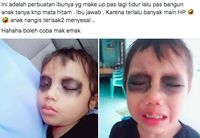 Viral Cerita Anak  Bermata Hitam Karna Keseringan Main  