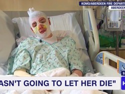 Kisah Heroik Pemuda Biarkan Tubuhnya Terbakar Demi Selamatkan Ponakan