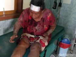 Satu Warga Banyuwangi Luka Imbas Gempa Bali