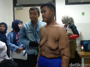 Usai Potong Lambung Seperti Aria, Bisakah Kembali Gemuk Lagi? Usai Potong Lambung Seperti Aria, Bisakah Kembali Gemuk Lagi?
