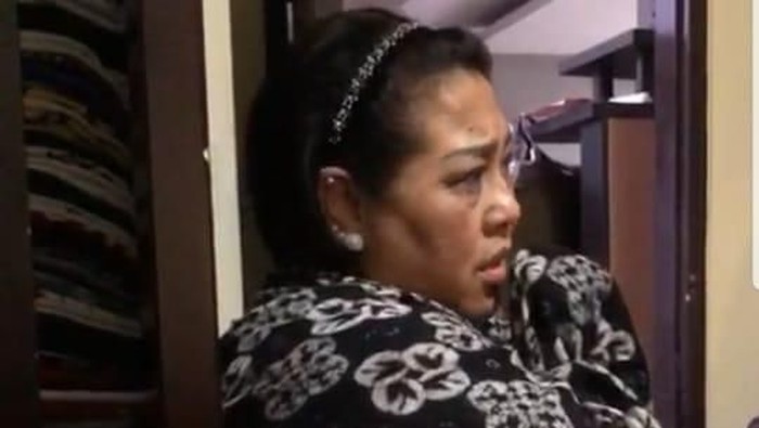 Secara fisik, Nunung disebut-sebut tidak tampak menyerupai pecandu narkoba sehingga banyak rekan dan kerabat yang tidak menyangka ia ditangkap polisi. (Foto: screenshoot video) Secara fisik, Nunung disebut-sebut tidak tampak menyerupai pecandu narkoba sehingga banyak rekan dan kerabat yang tidak menyangka ia ditangkap polisi. (Foto: screenshoot video)
