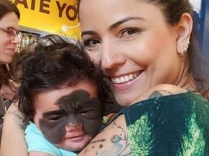 Dapat Pesan Kematian, Kisah Pilu Ibu yang Anaknya Punya Tanda Lahir di Wajah Dapat Pesan Kematian, Kisah Pilu Ibu yang Anaknya Punya Tanda Lahir di Wajah