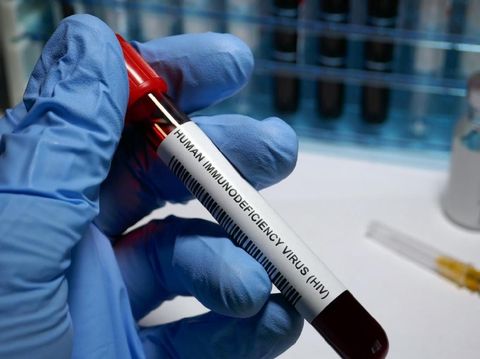 Pengidap HIV/AIDS Tinggi, Para Istri Dingatkan Tentang Banyak Suami Gay