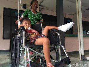 Bocah SD di Mojokerto Alami Luka Bakar Usai Terperosok ke Limbah Abu