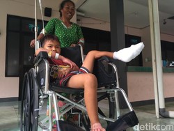 Bocah SD di Mojokerto Alami Luka Bakar Usai Terperosok ke Limbah Abu