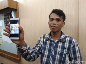 Kembar Siam Adam-Malik Sukses Dipisahkan, Ortu Tak Sabar Bawa ke Kampung