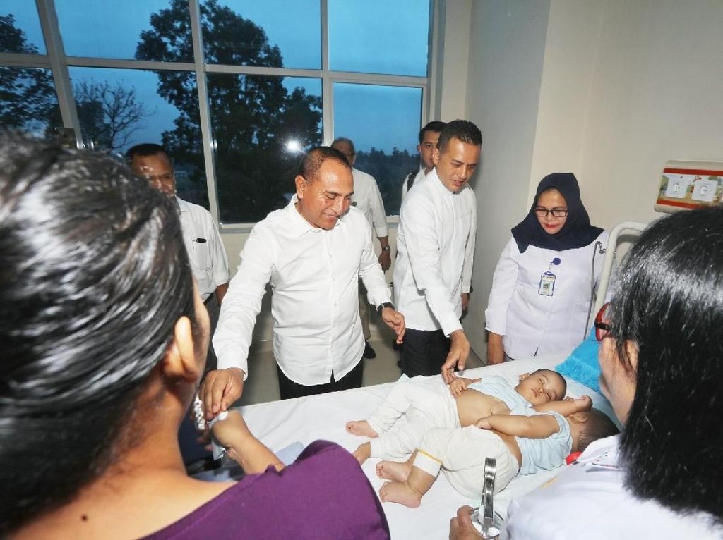 Gubernur Edy Sempat Stres Pikirkan Operasi Kembar Siam Adam-Malik