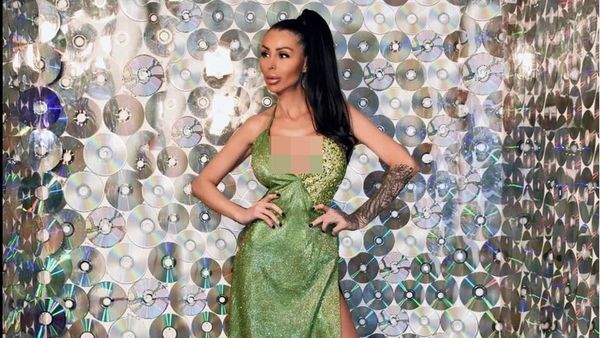 Foto: Model Bulgaria yang Dibully Mirip Alien Hingga Monster Setelah Oplas