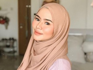 Peeling Murah Tapi Bikin Wajah Glowing Ini Viral, Bikin Wanita Penasaran Peeling Murah Tapi Bikin Wajah Glowing Ini Viral, Bikin Wanita Penasaran