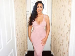 Ini Bentuk Tubuh Wanita yang 50 Kali Oplas, Termasuk 8 Kali Implan Payudara