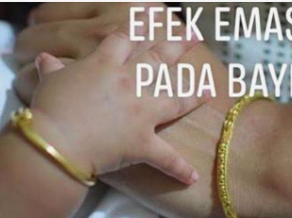 Viral Partikel Emas Perhiasan Bisa Menembus Kulit Bayi, Ini Kata Dokter Viral Partikel Emas Perhiasan Bisa Menembus Kulit Bayi, Ini Kata Dokter