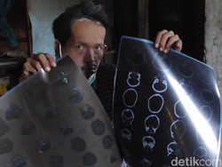 Idap Tumor, Pria di Polewali Mandar Sulbar Butuh Bantuan