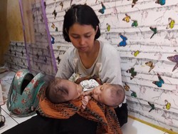 Menengok Rahman dan Rahim, Bayi Kembar di Bekasi yang Lahir Dempet