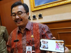 RSU Soetomo Siapkan Operasi Pemisahan Kembar Siam Dada dan Perut