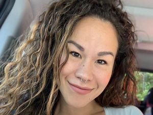 Wanita Ini Jadi Bau Badan dan Jerawatan Setelah Pasang Implan Payudara