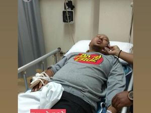 Patah Tulang karena Kecelakaan, Anggy Umbara Masih Bisa Tertawa