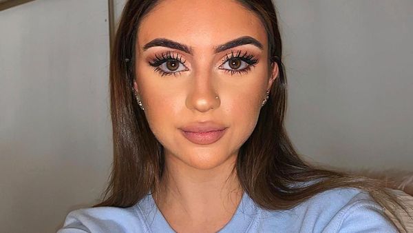 Wanita Ini Ungkap Cara Atasi Jerawat Parah, Tanpa Skincare & Perawatan Mahal