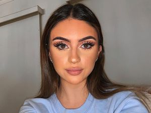 Wanita Ini Ungkap Cara Atasi Jerawat Parah, Tanpa Skincare & Perawatan Mahal