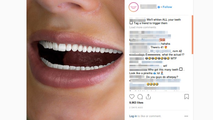 Ada berapa jumlah gigi di foto ini ya? Foto: Tangkapan layar Instagram