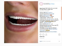 Pasang Gambar Menyeramkan, Iklan Pemutih Gigi Ini Heboh di Medsos