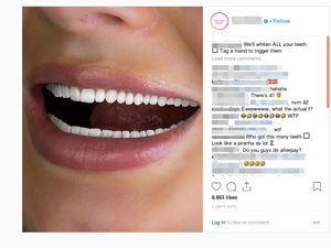 Pasang Gambar Menyeramkan, Iklan Pemutih Gigi Ini Heboh di Medsos Pasang Gambar Menyeramkan, Iklan Pemutih Gigi Ini Heboh di Medsos