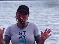 Iseng Taruh Gurita Beracun di Wajah, Wanita Ini Dilarikan ke RS