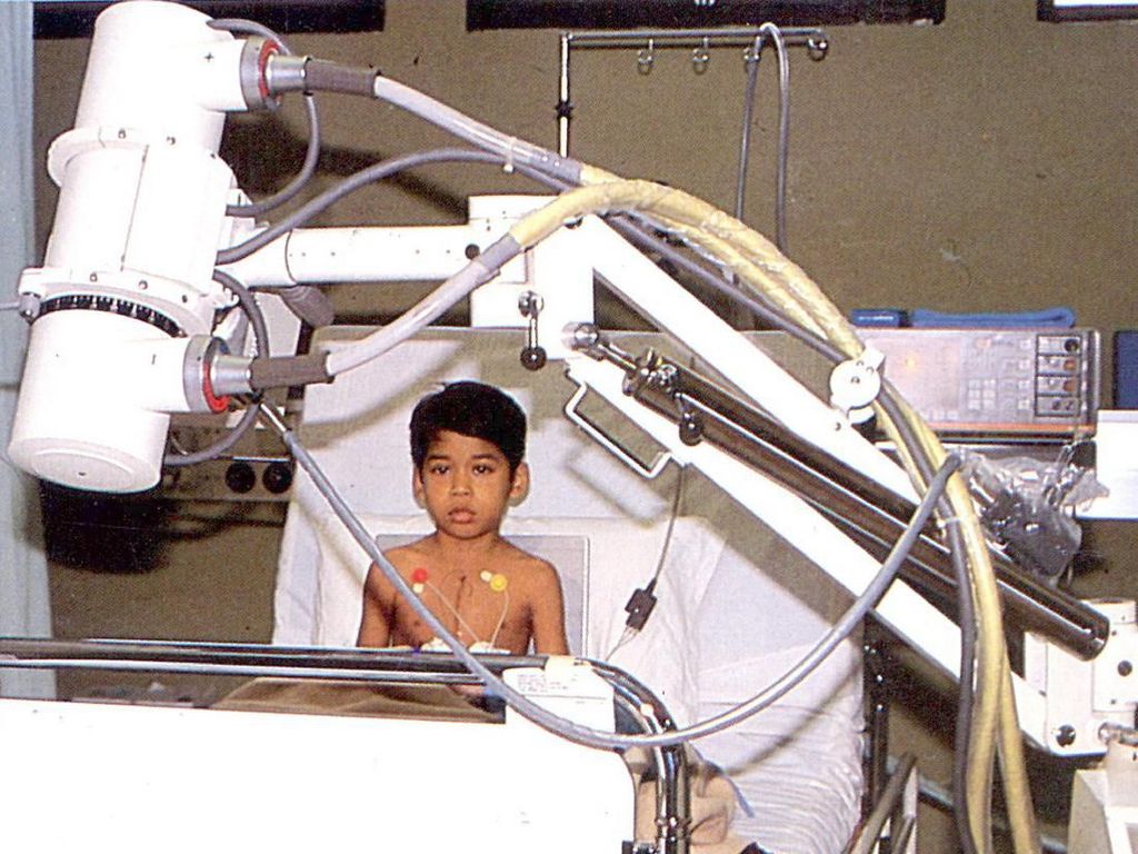 Ini Dia Pasien Operasi Jantung Pertama di RS Harapan Kita 34 Tahun Silam