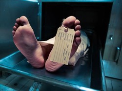 Waduh! Pria Ini Tewas Akibat Minum Soda Setiap Hari