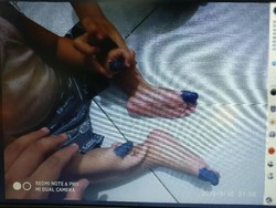Viral Anak Panas Diobati Tinta Spidol, Netizen Komentari Terapi Sujok