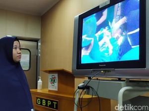 Jalani Operasi Pemisahan, Kembar Siam Asal Kendari Dinyatakan Sehat