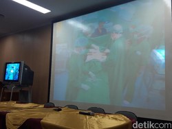 6 Jam Operasi, Kembar Siam Asal Kendari Berhasil Dipisahkan