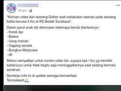 Viral Video Operasi Perut Balita Berisi Korek Api di Surabaya, Bagaimana Faktanya?