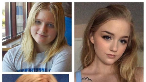 Foto Before-After Wanita yang Dulu Merasa Culun Kini Jadi Cantik