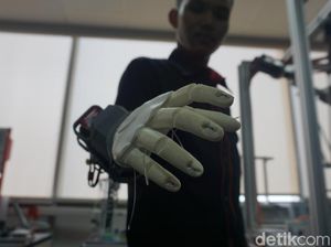 Terpopuler Akhir Pekan: Tangan Bionik Buatan Tangerang Bikin Bangga